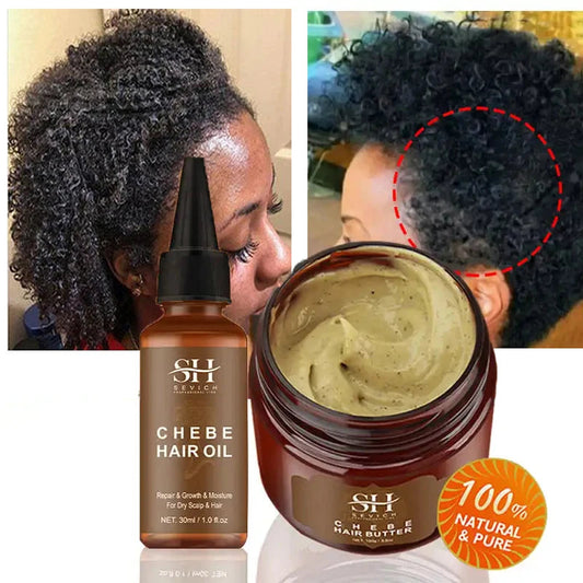 Chebe Traction Alopecia Thicken Oil Anti Hair Loss Treatment Spray Craze Fast Hair Growth  Products Sevich Anti Break Hair Care